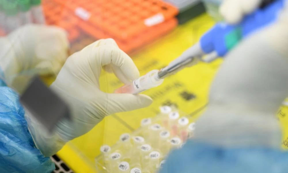 Κορονοϊός: Αναμένονται στην Ελλάδα τα γρήγορα μοριακά τεστ για τον ιό